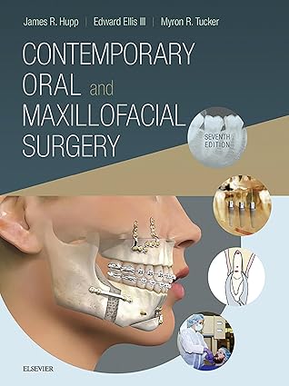 Contemporary Oral And Maxillofacial Surgery by James R. Hupp, Edward Ellis III, Myron R. Tucker
